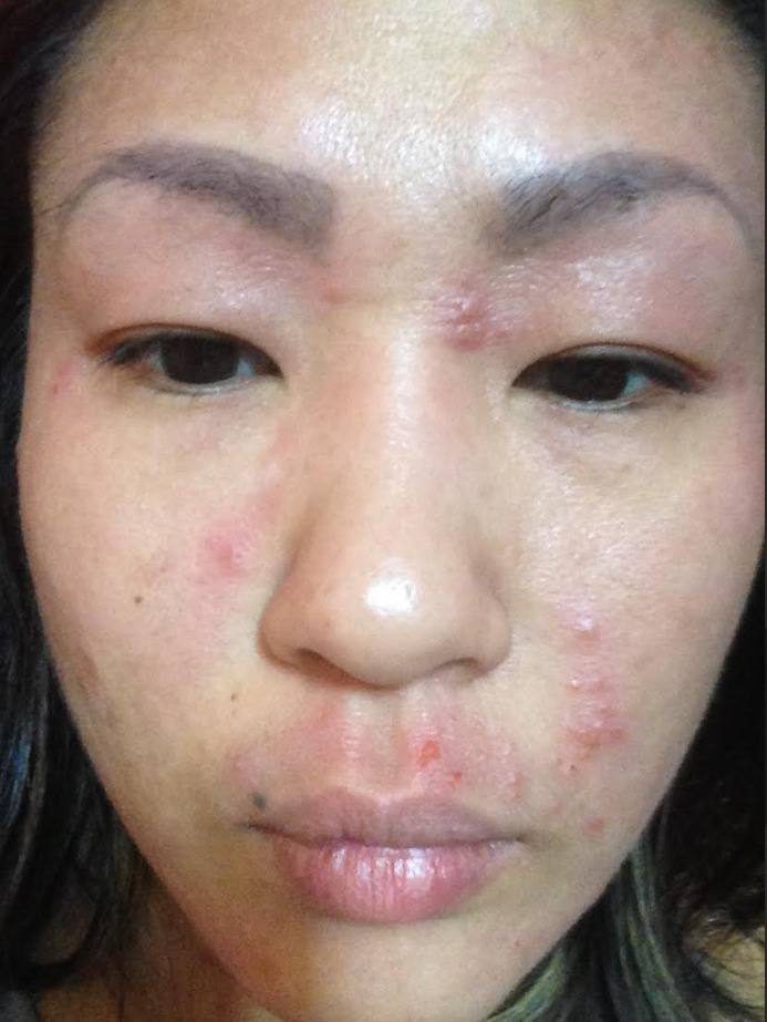 Samantha’s face, skin flared